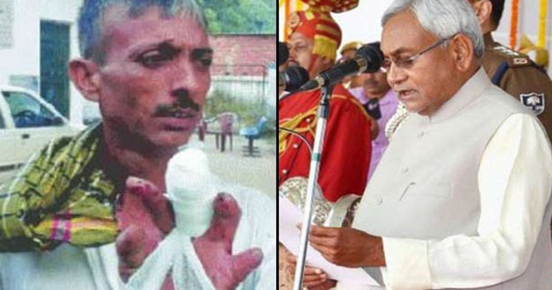 Man chops off his finger