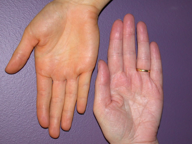 Carrots And Dates Change Your Skin Color