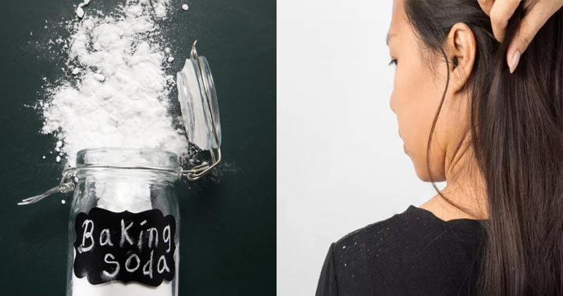 Baking Soda Remedies