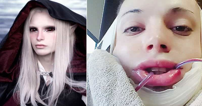 Luis Padron Human Elf