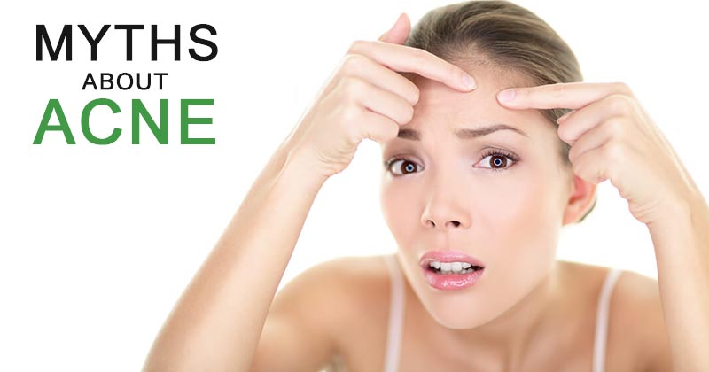 MYTHS about ACNE