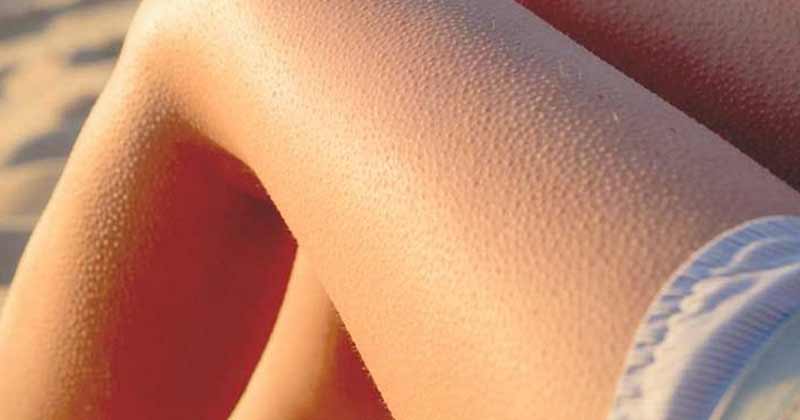 Why Do We Get Goosebumps