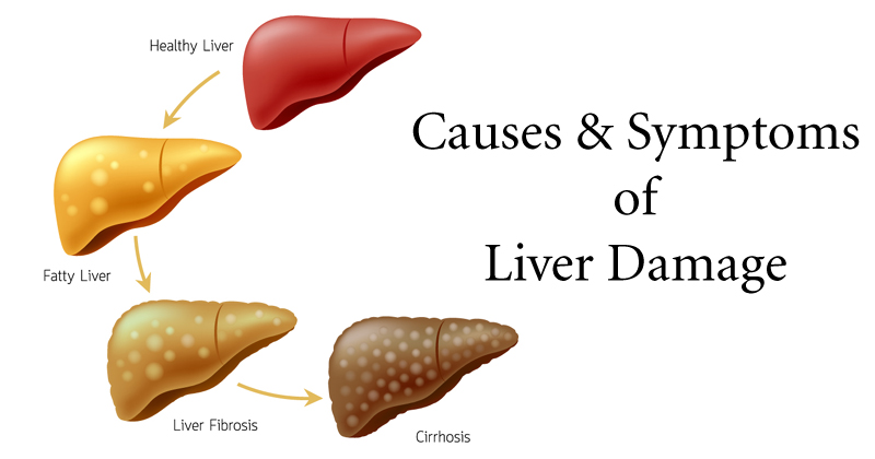 symptoms of liver damage