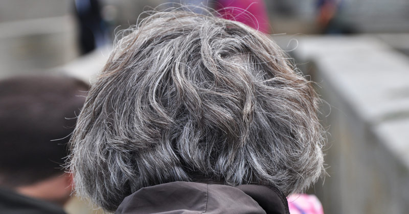 Premature Graying of Hair | Canities