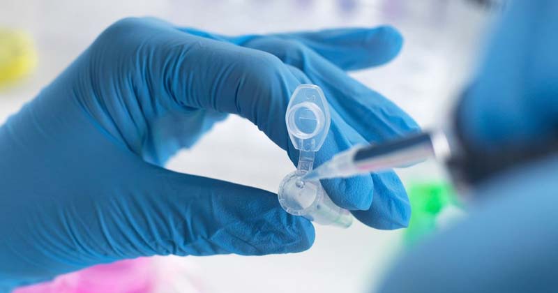 What is DexamethasoneWhat is Dexamethasone