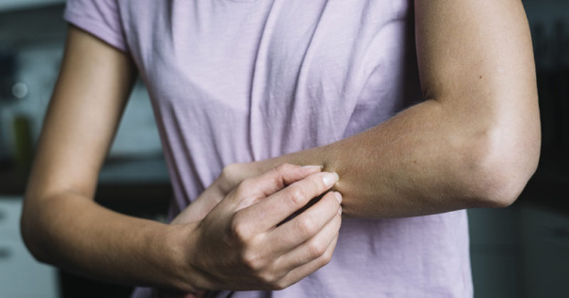 Home Remedies For Skin Allergies