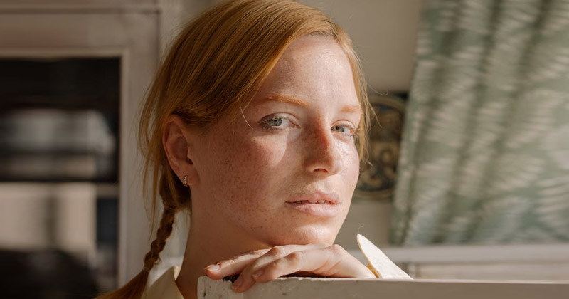 Home Remedies for Skin pigmentation