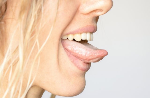What Is White Tongue: Causes, Treatement & Prevention