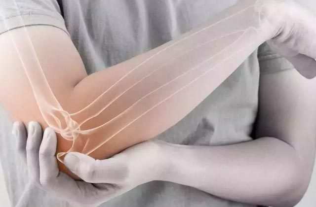 Vitamin D Deficiency