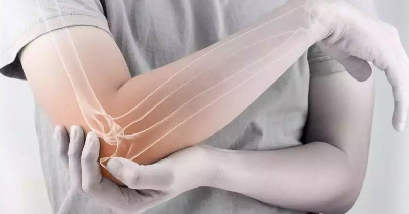 Vitamin D Deficiency