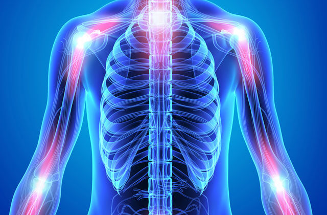 Inflammation Types and Symptoms