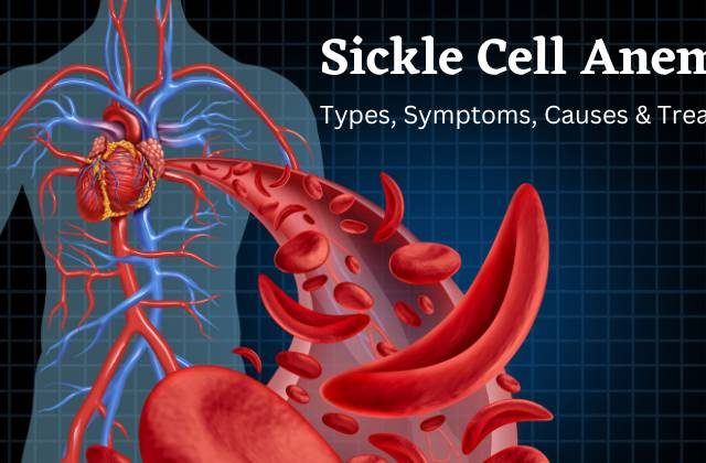 Sickle Cell Anemia