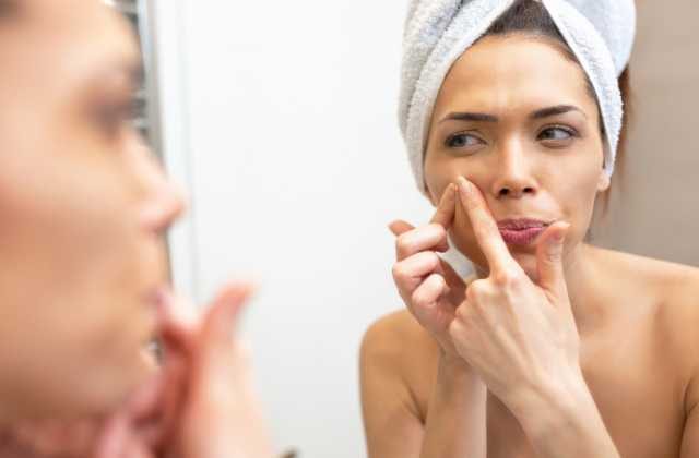 How to Get Rid of Acne