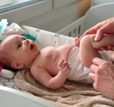 Diaper Rash Prevention and Treatment