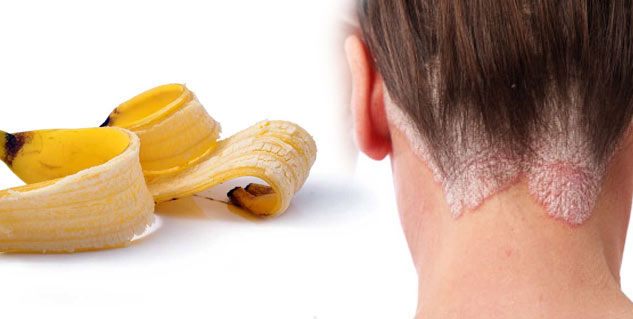 Benefits Of Banana Peel : Curing Skin, Teeth & Psoriasis Diseases